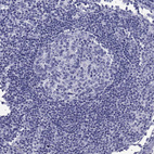 Immunohistochemical staining of human lymph node shows no positivity in germinal center cells as expected.