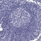 Immunohistochemical staining of human lymph node shows no positivity in germinal center cells as expected.