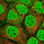 Immunofluorescent staining of human cell line CACO-2 shows localization to nucleoplasm & cytosol.
