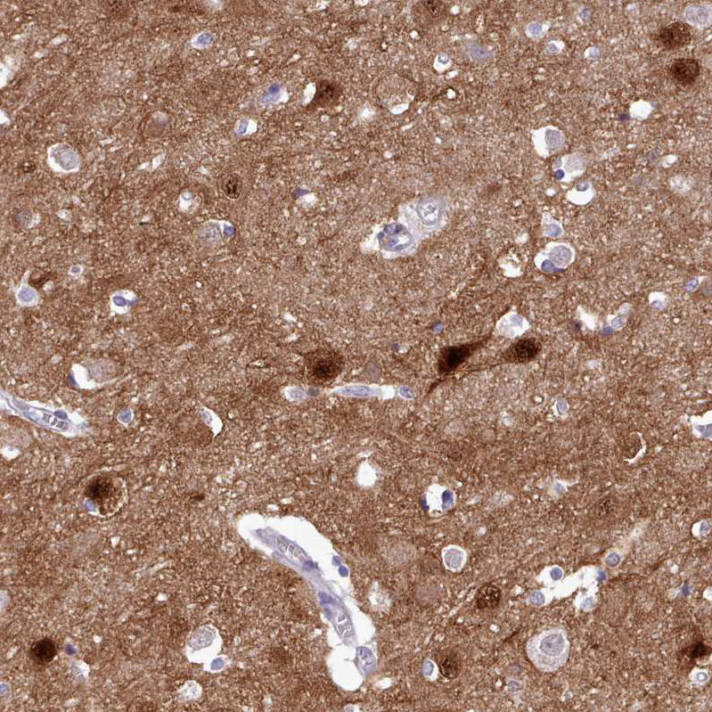 Anti-KCTD16 Antibody