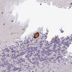Immunohistochemical staining of human cerebellum shows strong cytoplasmic positivity in Purkinje cells.