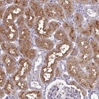 Immunohistochemical staining of human kidney shows strong cytoplasmic positivity in cells in tubules.