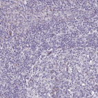 Immunohistochemical staining of human tonsil shows no positivity in non-germinal center cells as expected.