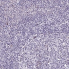 Immunohistochemical staining of human tonsil shows no positivity in non-germinal center cells as expected.