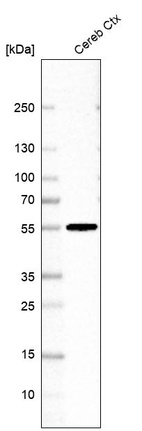Western blot analysis in human cerebral cortex tissue.