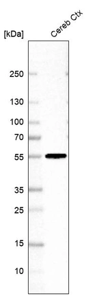 Western blot analysis in human cerebral cortex tissue.