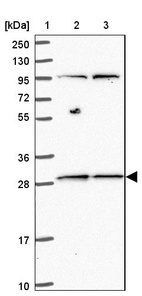 Lane 1: Marker [kDa] 250, 130, 95, 72, 55, 36, 28, 17, 10_br/_Lane 2: Human cell line RT-4_br/_Lane 3: Human cell line U-251MG sp