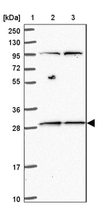 Lane 1: Marker [kDa] 250, 130, 95, 72, 55, 36, 28, 17, 10_br/_Lane 2: Human cell line RT-4_br/_Lane 3: Human cell line U-251MG sp