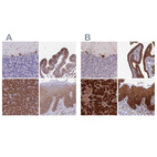 Anti-RPL8 Antibody
