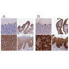 Anti-RPL8 Antibody