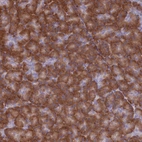 Immunohistochemical staining of human pancreas shows strong cytoplasmic positivity in exocrine glandular cells.