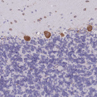 Immunohistochemical staining of human cerebellum shows strong cytoplasmic positivity in Purkinje cells.