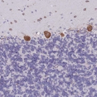 Immunohistochemical staining of human cerebellum shows strong cytoplasmic positivity in Purkinje cells.