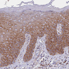 Immunohistochemical staining of human skin shows moderate cytoplasmic positivity in squamous epithelial cells.