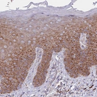 Immunohistochemical staining of human skin shows moderate cytoplasmic positivity in squamous epithelial cells.