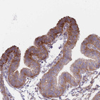 Immunohistochemical staining of human Fallopian tube shows moderate cytoplasmic positivity in glandular cells.
