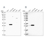 Western blot analysis using Anti-RPL8 antibody HPA050165 (A) shows similar pattern to independent antibody HPA045095 (B).