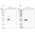 Western blot analysis using Anti-RPL8 antibody HPA050165 (A) shows similar pattern to independent antibody HPA045095 (B).