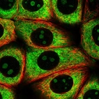 Immunofluorescent staining of human cell line MCF7 shows localization to nucleoli, cytosol & endoplasmic reticulum.
