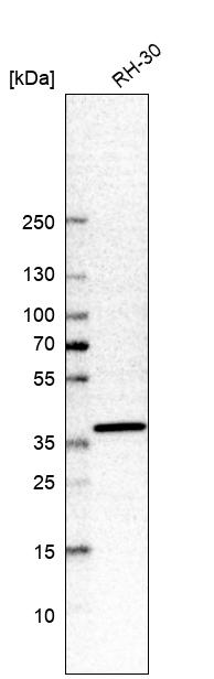Anti-SHISA2 Antibody