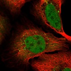 Immunofluorescent staining of human cell line U-2 OS shows localization to nucleoplasm & vesicles.