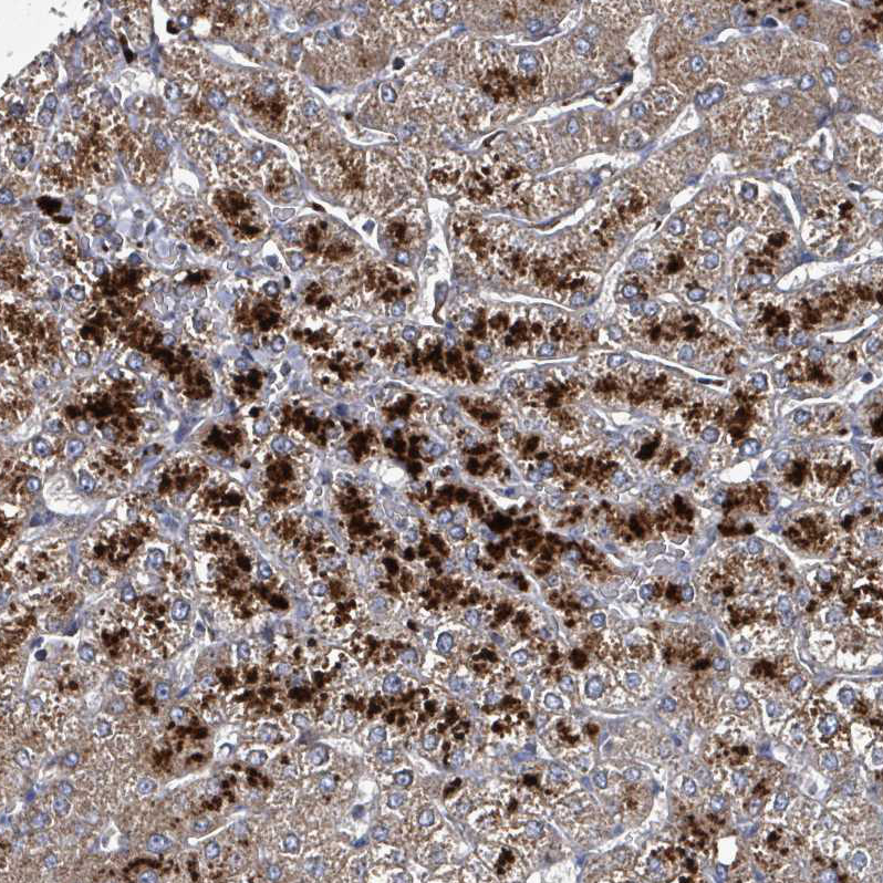 Anti-ABHD18 Antibody