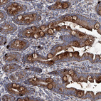 Immunohistochemical staining of human small intestine shows strong cytoplasmic positivity in goblet cells.