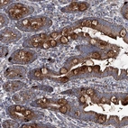 Immunohistochemical staining of human small intestine shows strong cytoplasmic positivity in goblet cells.