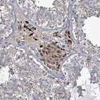 Immunohistochemical staining of human testis shows strong cytoplasmic positivity in Leydig cells.