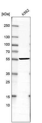 Western blot analysis in human cell line K562.