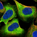Immunofluorescent staining of human cell line U-2 OS shows localization to cytosol.