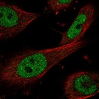 Anti-ERCC1 Antibody