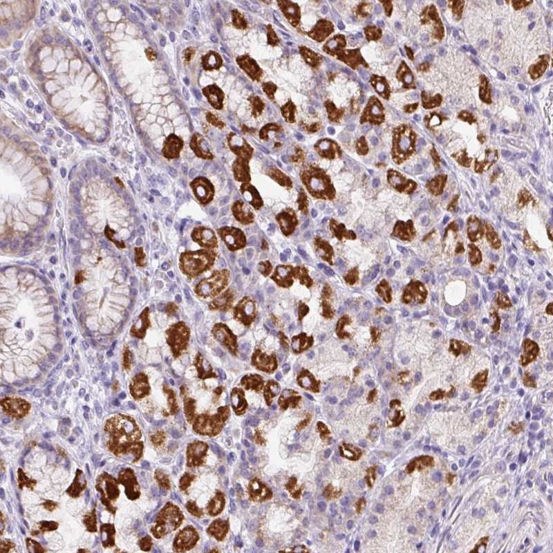 Anti-HPS4 Antibody