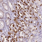 Anti-HPS4 Antibody