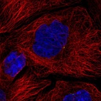 Immunofluorescent staining of human cell line A-431 shows localization to centrosome.
