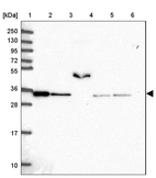 Lane 1: Marker [kDa] 250, 130, 95, 72, 55, 36, 28, 17, 10_br/_Lane 2: Human cell line RT-4_br/_Lane 3: Human cell line U-251MG sp_br/_Lane 4: Human plasma (IgG/HSA depleted)_br/_Lane 5: Human liver tissue_br/_Lane 6: Human tonsil tissue