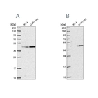 Western blot analysis using Anti-WDR18 antibody HPA050200 (A) shows similar pattern to independent antibody HPA050193 (B).