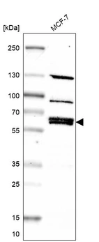 Anti-NPNT Antibody