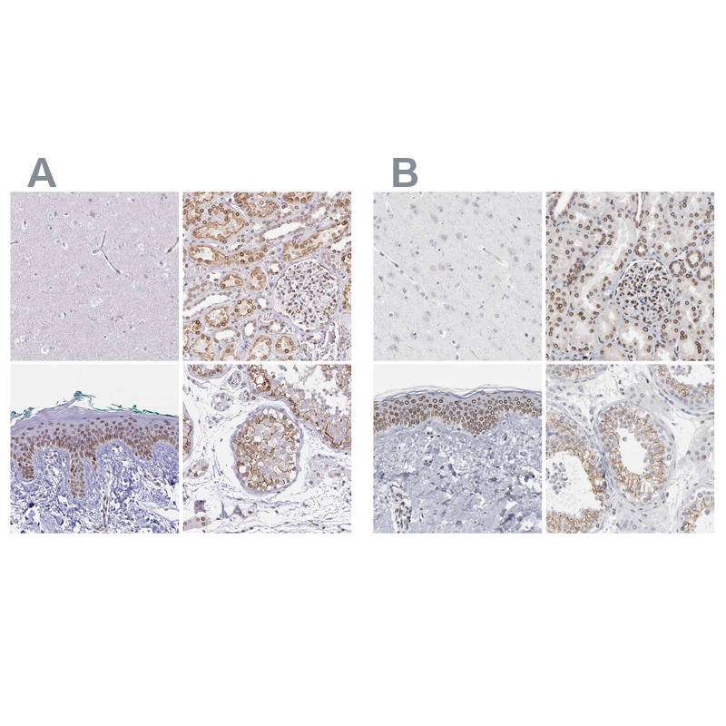 Anti-SYNE2 Antibody