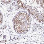 Immunohistochemical staining of human testis shows moderate membranous positivity in cells in seminiferous ducts.