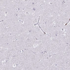 Immunohistochemical staining of human cerebral cortex shows no positivity in neurons as expected.