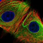 Immunofluorescent staining of human cell line MCF7 shows localization to nuclear membrane & intermediate filaments.