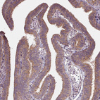 Immunohistochemical staining of human fallopian tube shows moderate positivity in apical membrane in glandular cells.