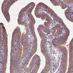 Immunohistochemical staining of human fallopian tube shows moderate positivity in apical membrane in glandular cells.