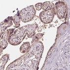 Immunohistochemical staining of human placenta shows moderate cytoplasmic and membranous positivity in trophoblastic cells.