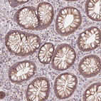 Immunohistochemical staining of human colon shows moderate membranous and cytoplasmic positivity in glandular cells.