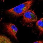 Immunofluorescent staining of human cell line U-251 MG shows localization to cytosol & the Golgi apparatus.
