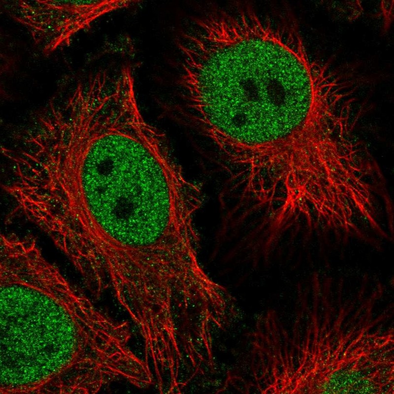 Anti-HMG20B Antibody
