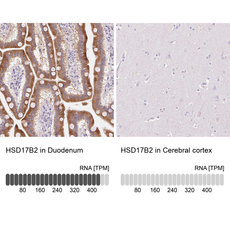 Anti-HSD17B2 Antibody