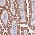 Immunohistochemical staining of human duodenum shows high expression.